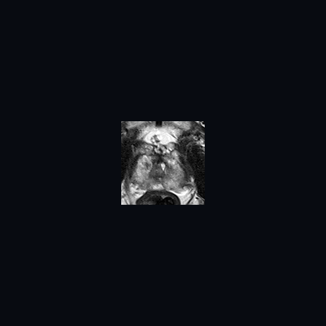 Demo: ground-truth anatomy MRI preview