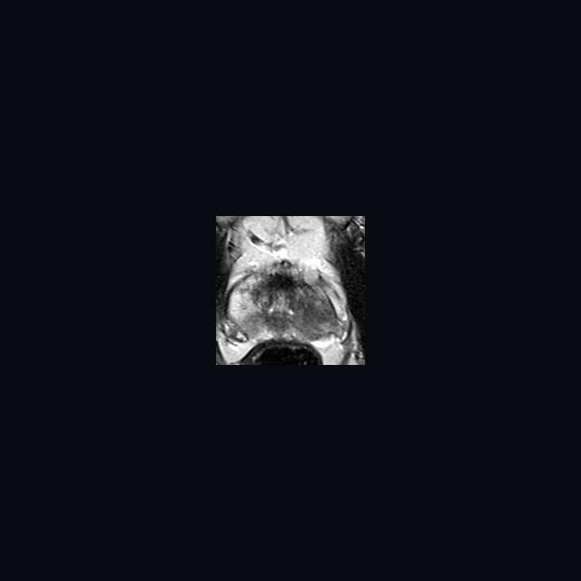 Demo: AI-segmented anatomy T2 axial source preview